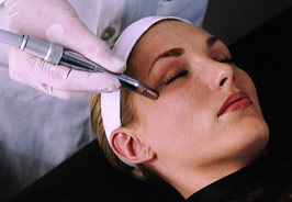 microdermabrasion