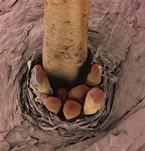 eyelash mites