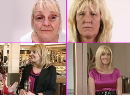 younger years before after tv challenge look beaut ie bottom want surgery plastic sheila dawn left right who