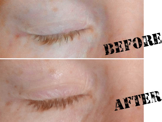 rapidlash before and after