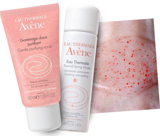 avene