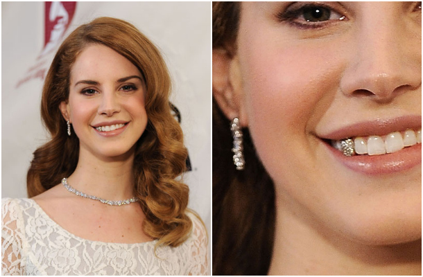 Captain Jack Sparrow called, Lana. He wants his gold tooth back.