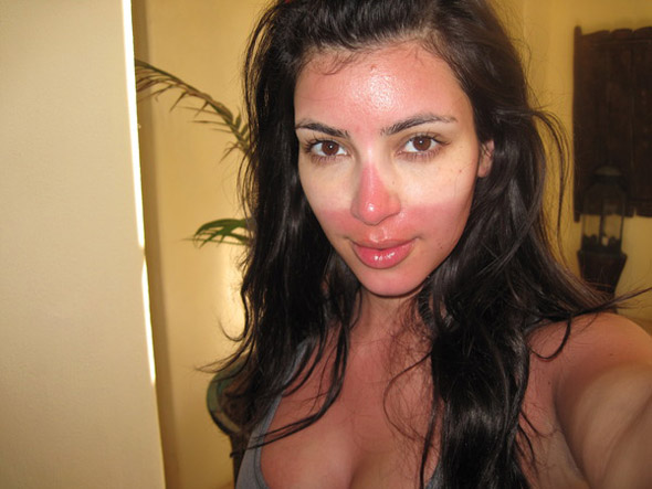kim-kardashian-sunburned