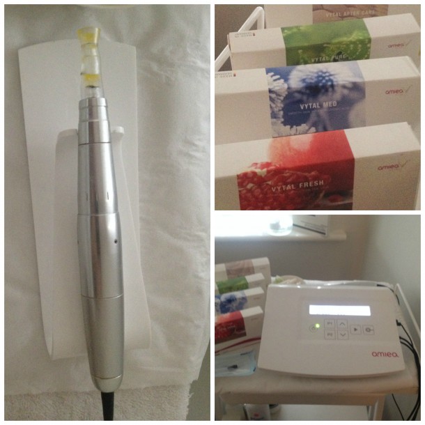 Clockwise from left to right: Needling system (after the treatment); Meso Vytal Formulas; the Meso Vytal Machine