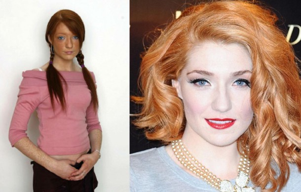 Nicola Roberts, before and after (Images courtesy of Rex/PA)