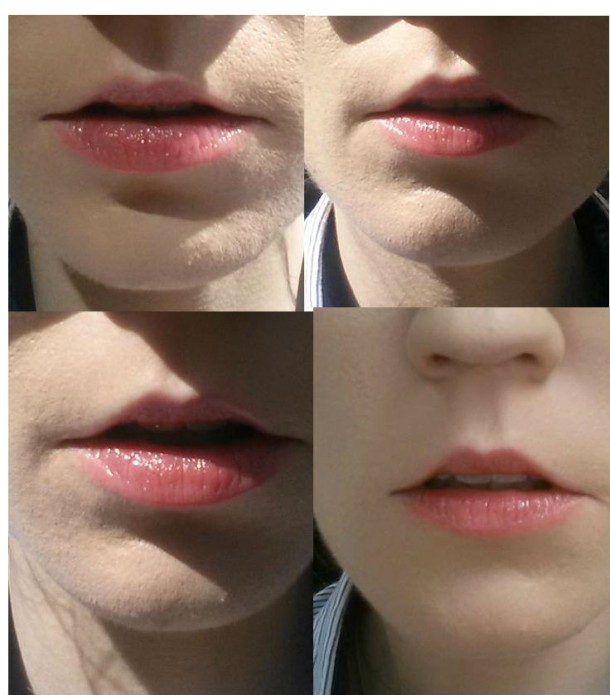 lips 2