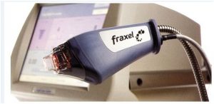 fraxel1